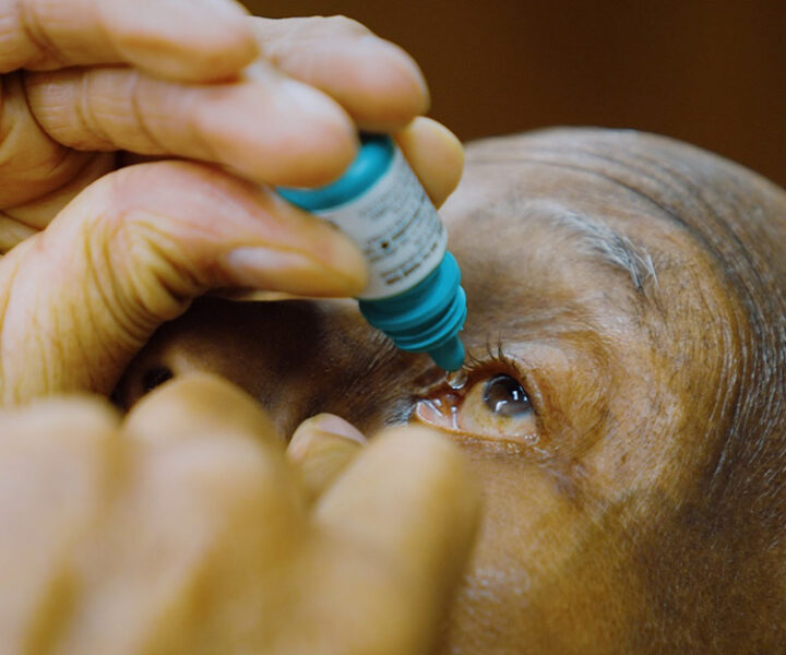 How to Take Eye Drop Medications